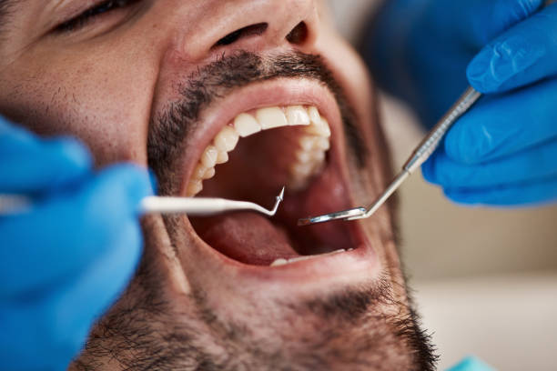 Best Emergency Care for Gum Disease in Pahrump, NV